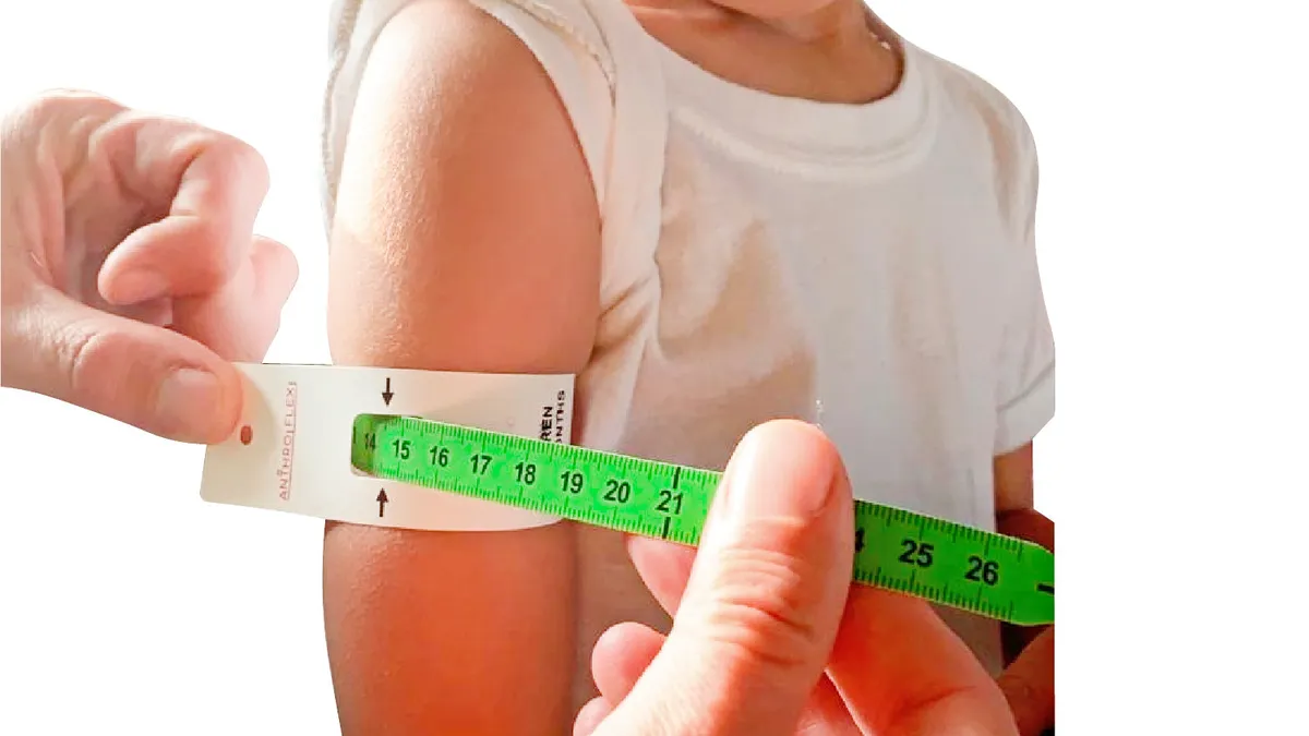 Avaliação Nutricional no Paciente Pediátrico e Curvas de Crescimento da OMS: Escore-Z e Percentis