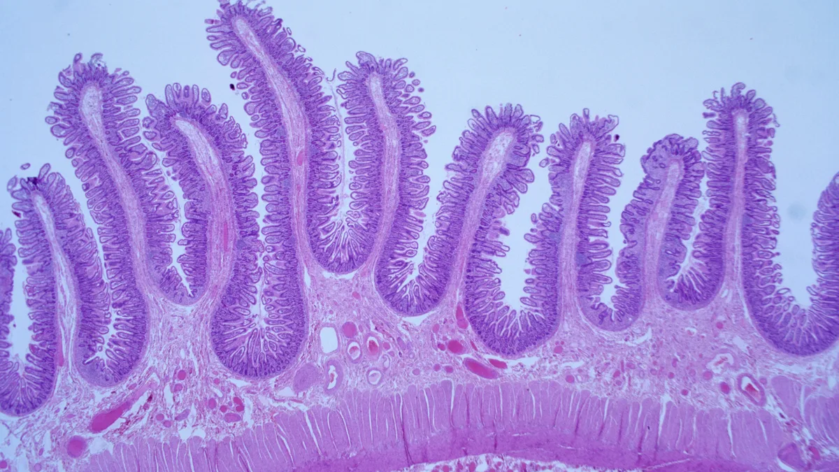 Crohn e Retocolite: Nutrição Enteral Exclusiva, Dieta CDED, Emulsificantes e Butirato