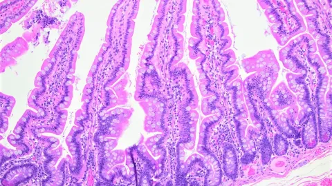 Permeabilidade Intestinal e o Protocolo dos 5Rs na Prática Clínica