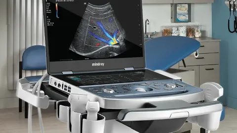 Ultrassonografia Muscular de Quadríceps na Detecção Precoce de Sarcopenia